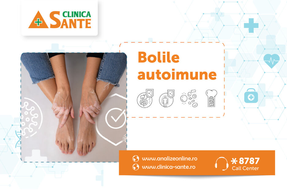 Boli autoimune