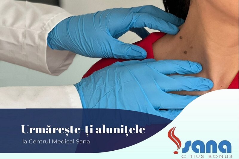 Ofertă Dermatologie prevenție - Centrul Medical Sana