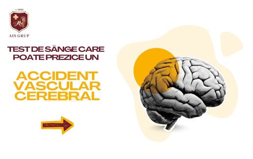 Testează nivelul homocisteinei